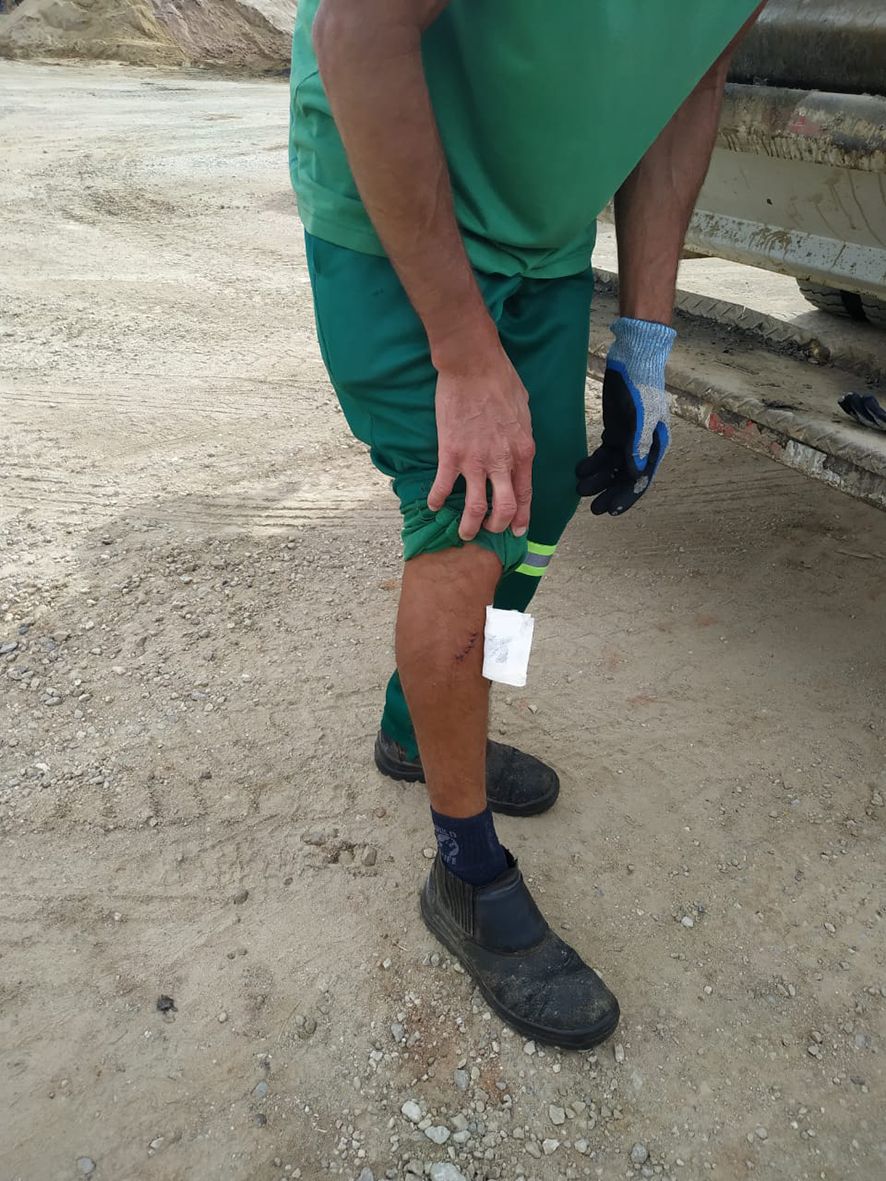 Vidro fere coletores e prefeitura faz alerta